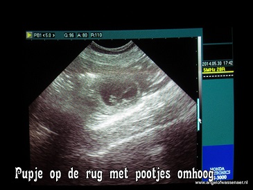 Echo met embryo in beeld